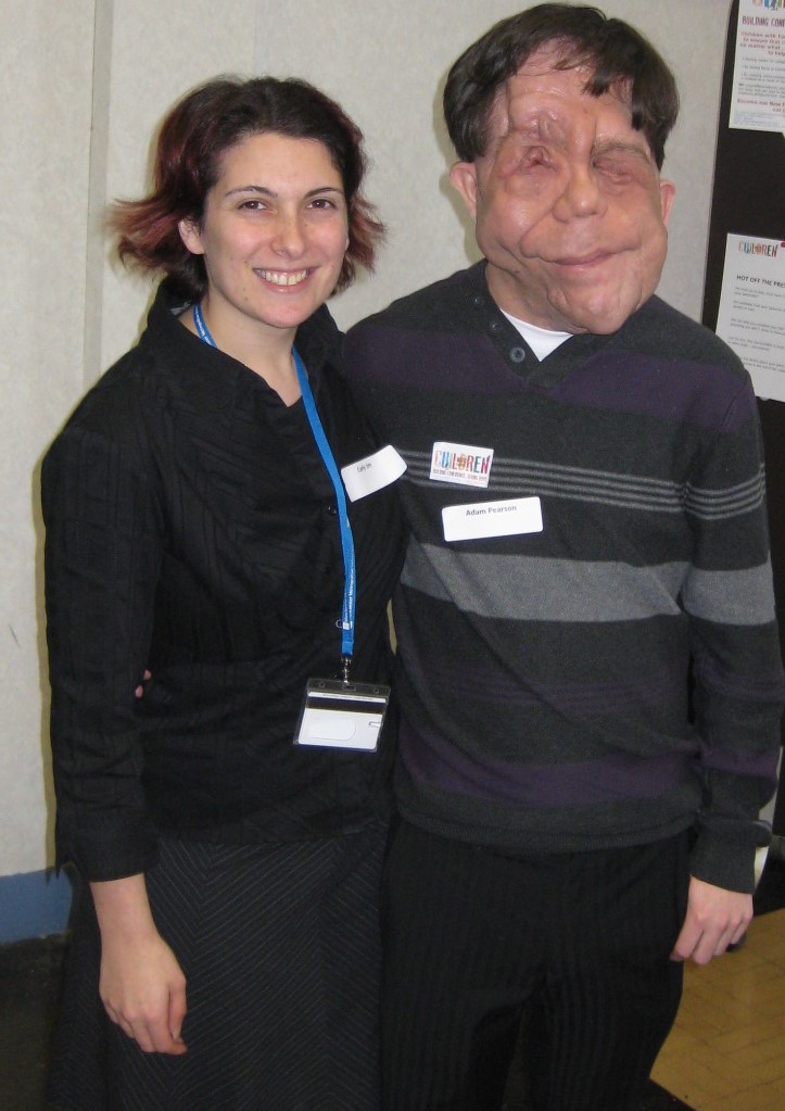 Dr Carly Jim, Senior Lecturer in Psychology, and presenter Adam Pearson pictured at an NF1 conference held at Manchester Metropolitan University in 2012