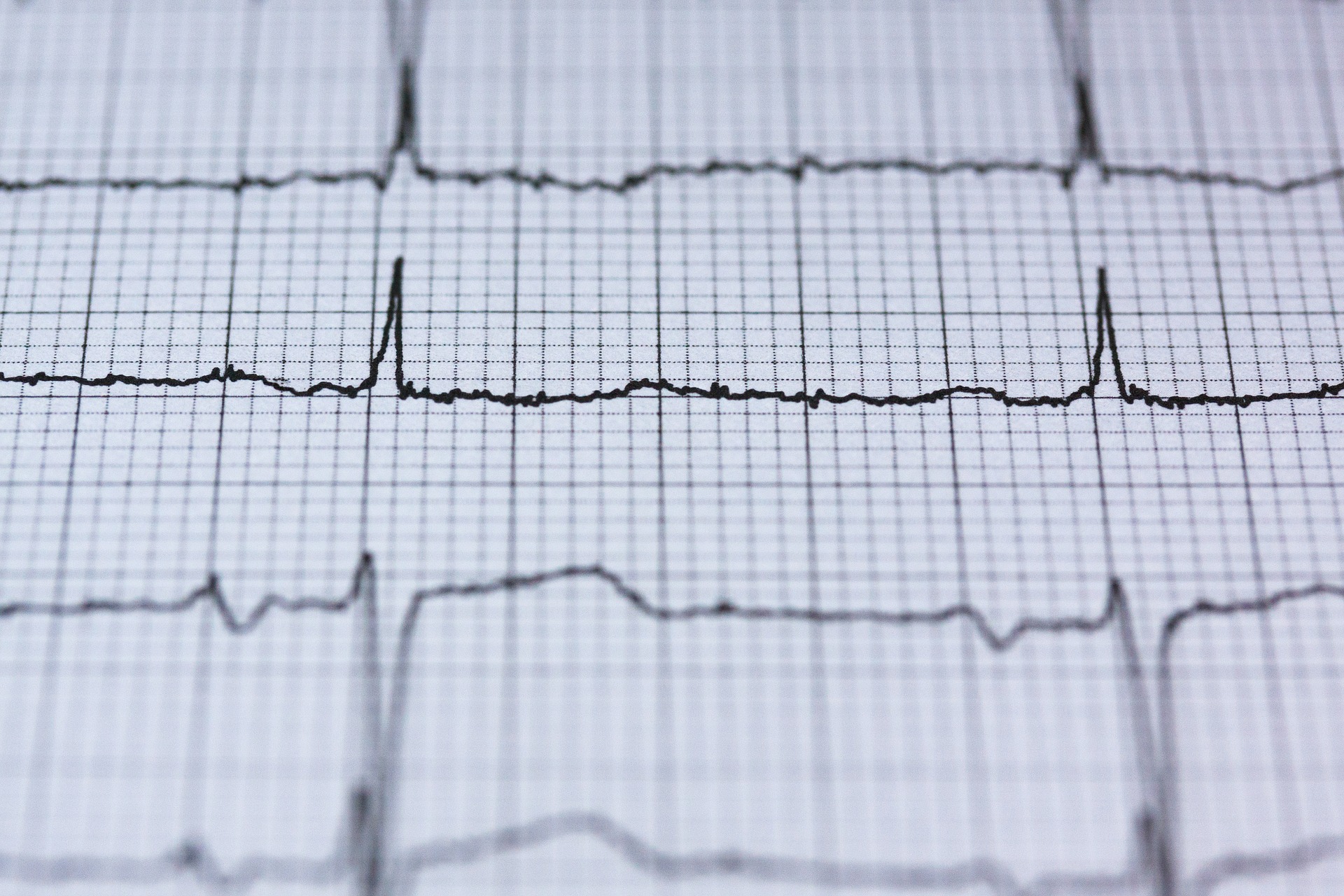 Can heart screening detect possible cardiac arrests? 